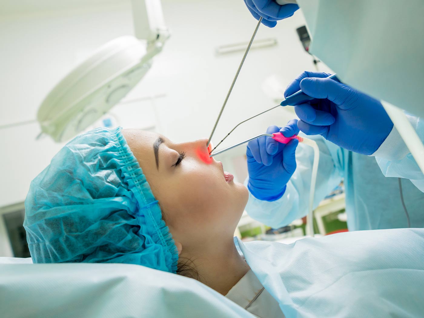 Plastic surgery | Sinus surgery experience