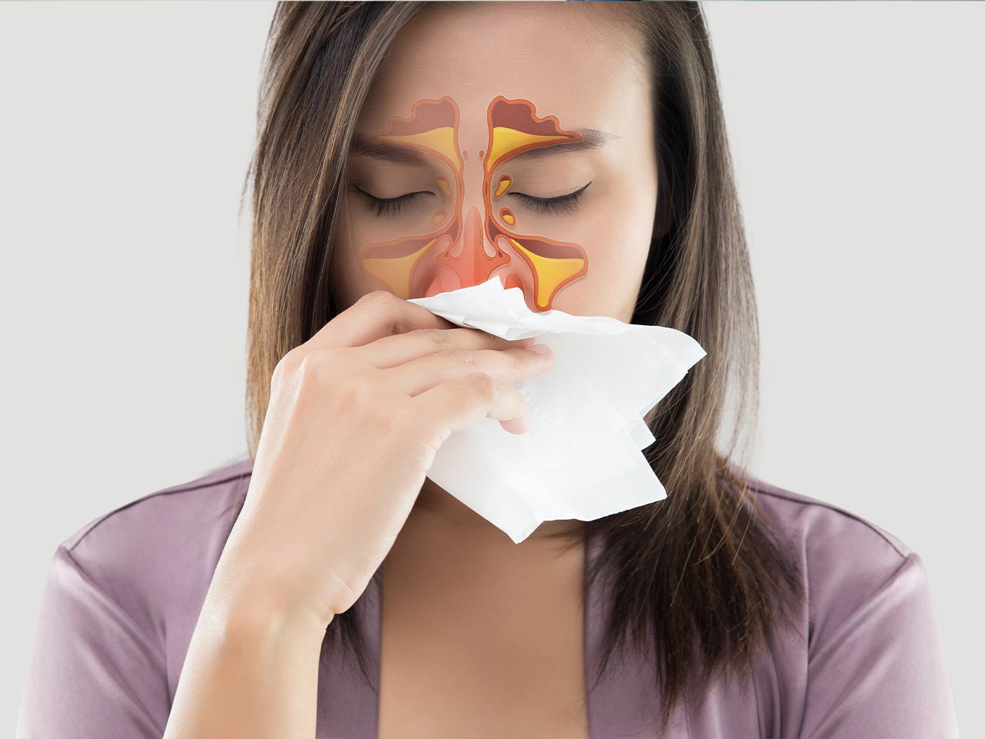 Plastic surgery | Sinus surgery
