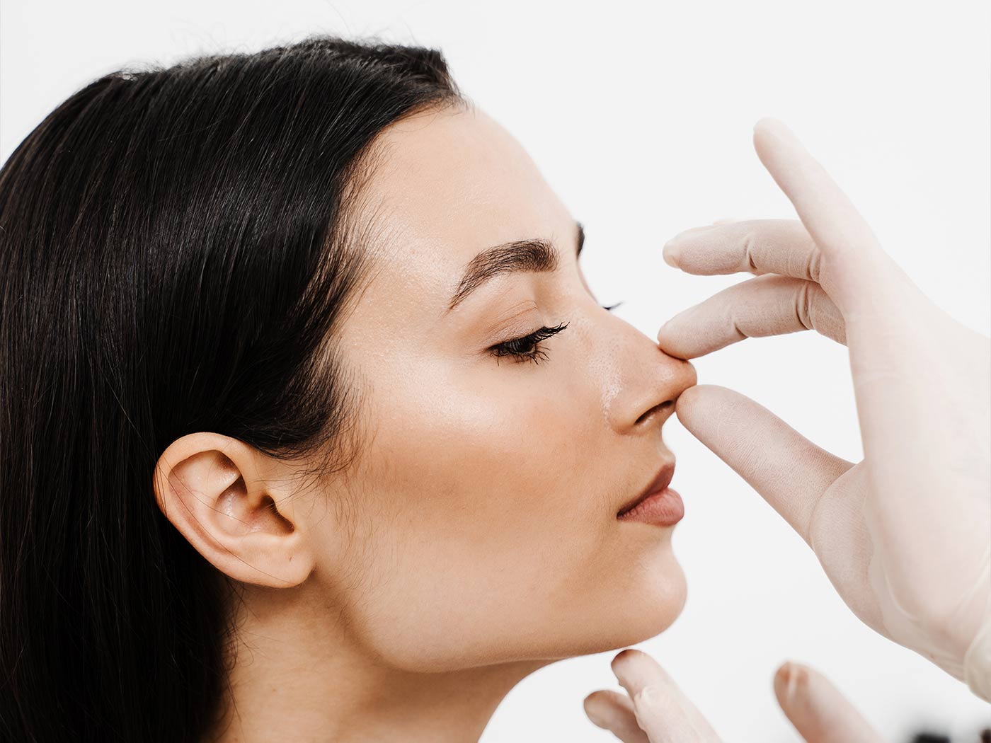 Estetska kirurgija | Sekundarna rinoplastika