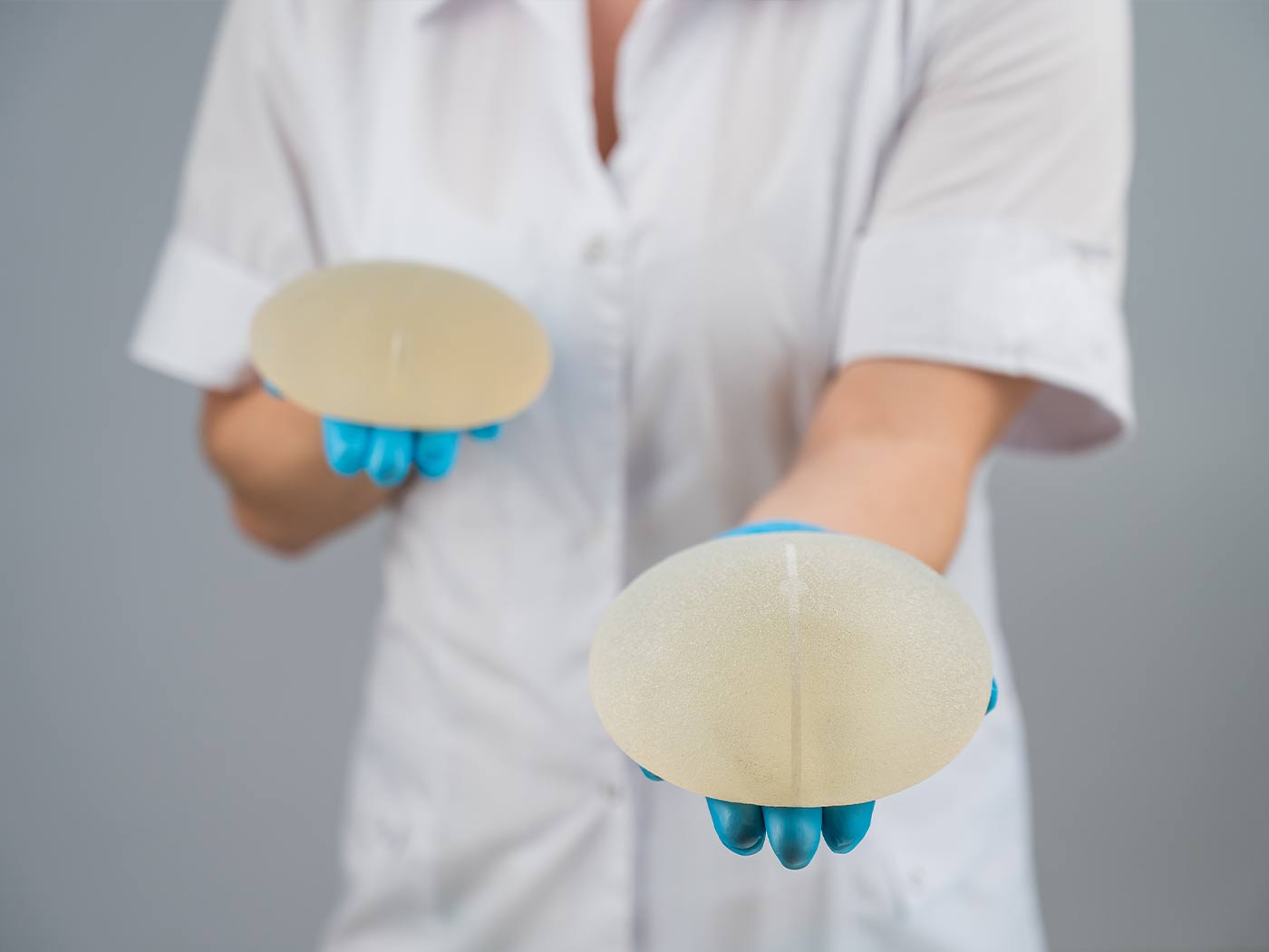 Estetska kirurgija | Silikon u grudima 350 kubičnih centimetara