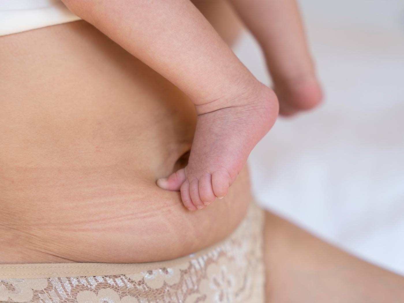 Plastic surgery | Mommy Makeover