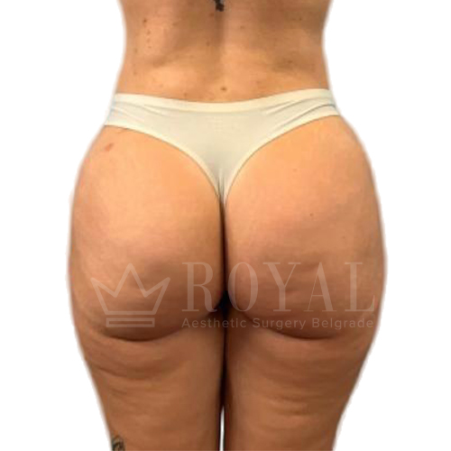 Estetska kirurgija | Prije i poslije