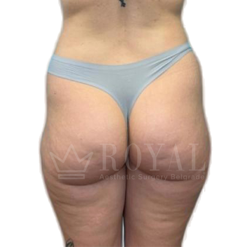 Estetska kirurgija | Prije i poslije