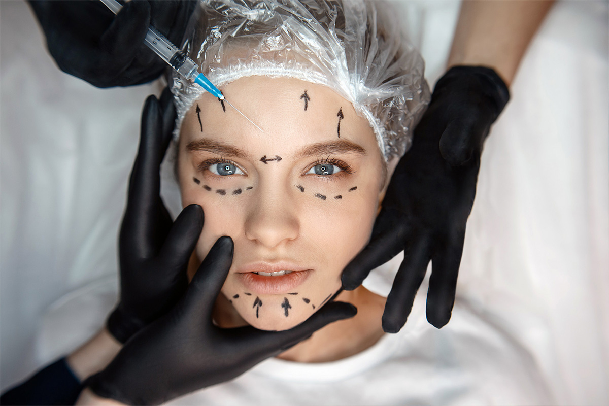 Facelifting | Facelifting